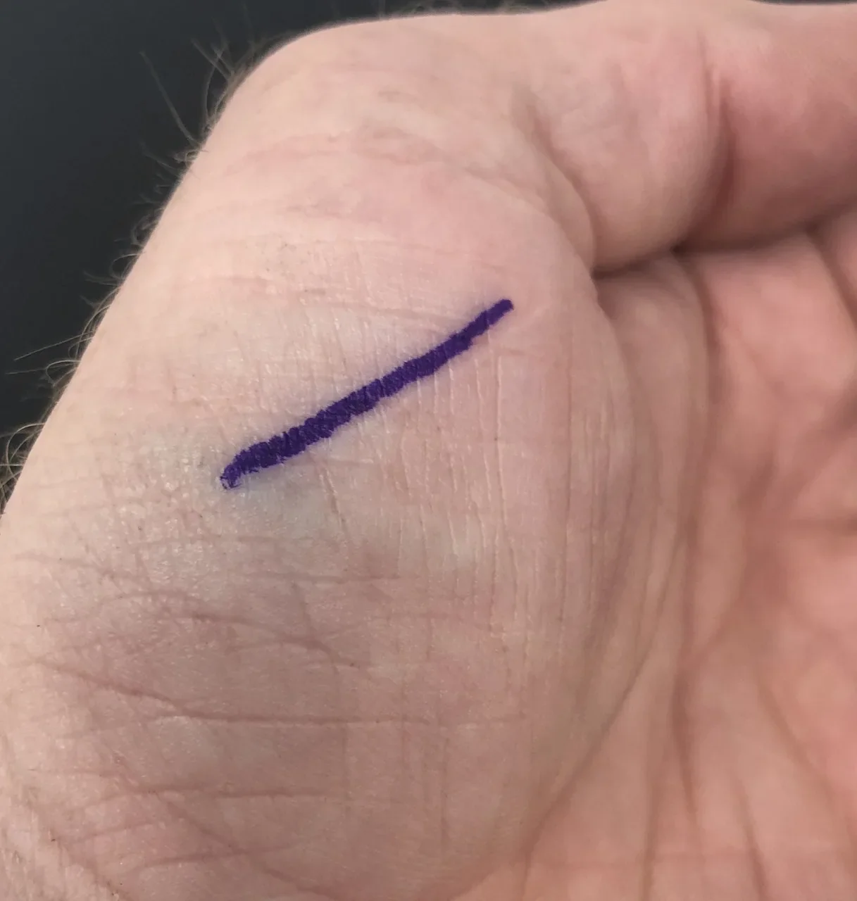 Electrum Tattoo Stencil Marker - Image 2
